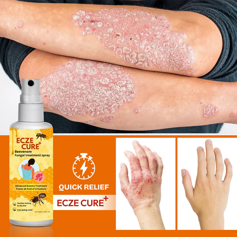 Eczecure+™ Bee Venom Fungal Treatment Spray 🐝✨(Buy 1 Get 1 Free🔥)