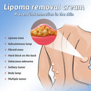 Premium QB™ Herbal Lipoma Removal Cream (50gm) - ✅Doctors Recommended Regular price