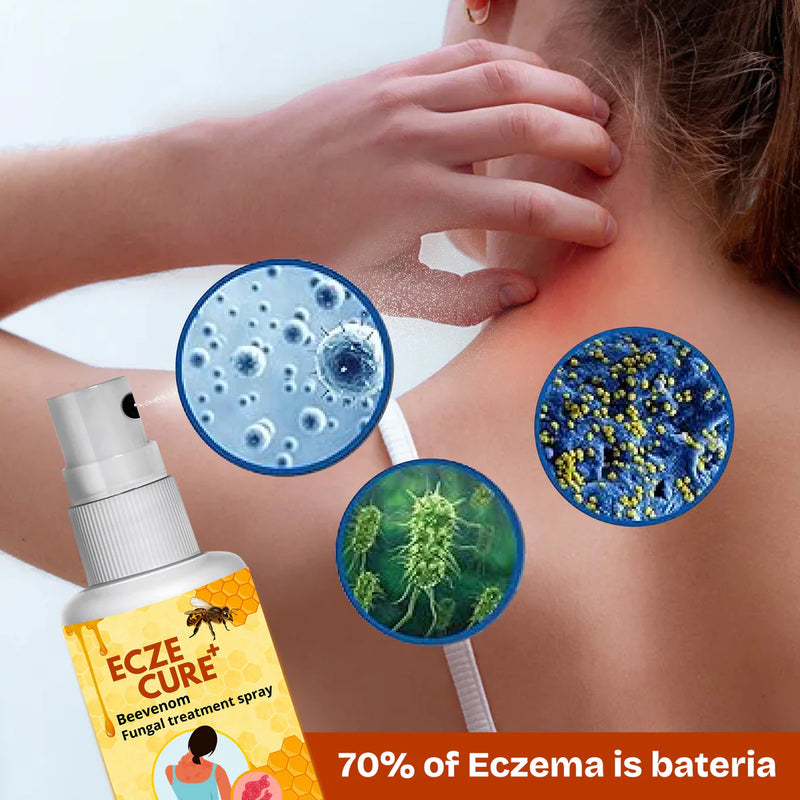 Eczecure+™ Bee Venom Fungal Treatment Spray 🐝✨(Buy 1 Get 1 Free🔥)