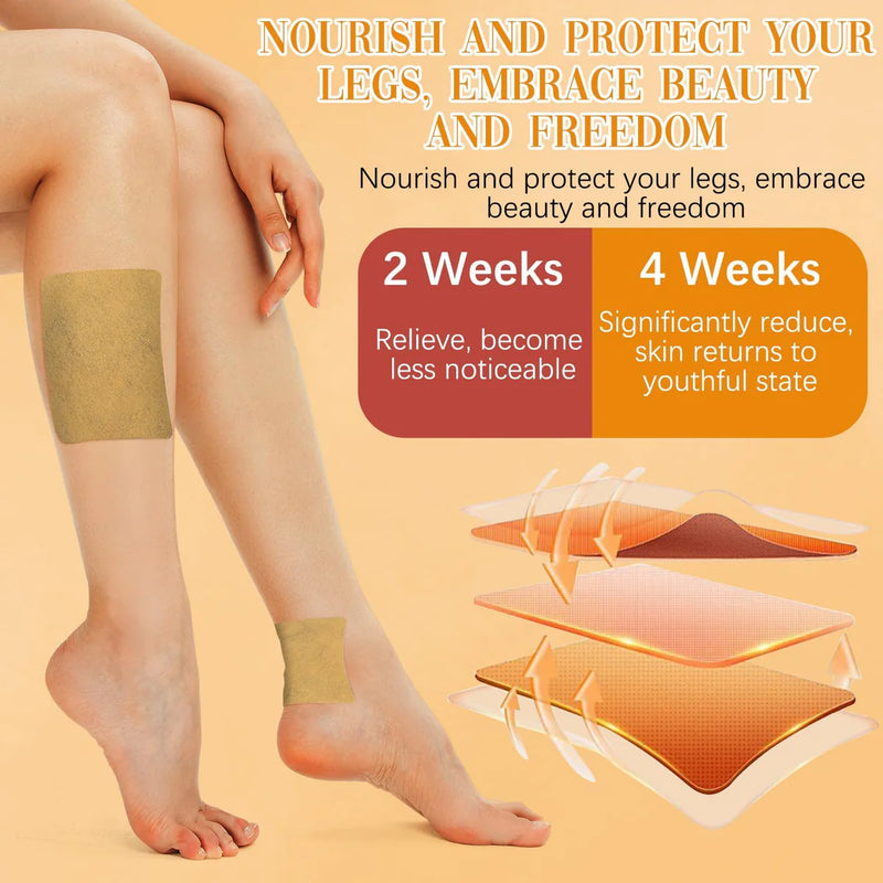VeinGuard™ - Instant Relief Varicose Vein Patches with Free Pain Relief Spray (Buy 1 get 1 Free🔥)