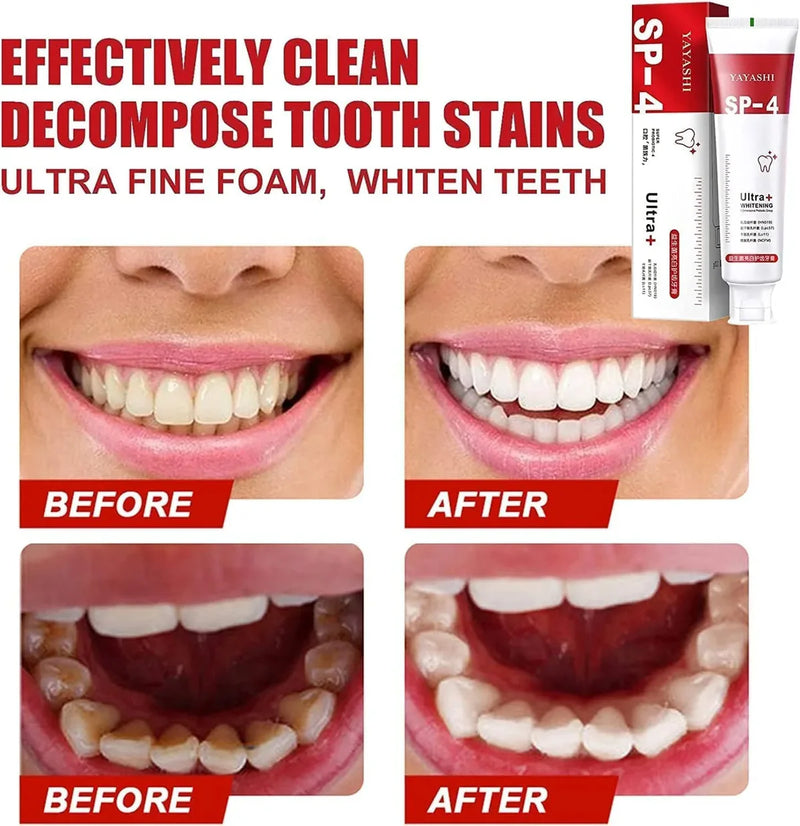 BrightenUp™ - SP-4 Ultra+ Teeth Whitening W Free Mist