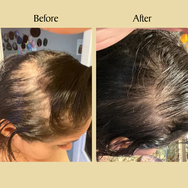 Jamalgota Ayurvedic Hair Growth Powder with Free Growth Spray