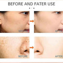 Dermo™ Saam Renewal Face Cream, Remove Wrinkles, Melasma, Freckles, Skin Aging, Dark skin