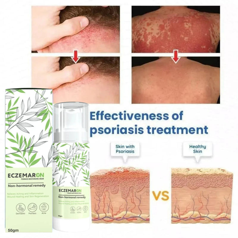 EczeMaron Oil Free Cream OFFER | Buy 1 Get 1 Free
