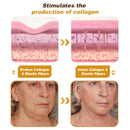 BeeTox™ - Bee Venom Wrinkle Repair Cream 🐝✨ (Buy 1 Get 1 Free 🔥🔥)