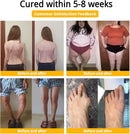 BeeFlex™ - Bee-Venom Pain-Relief Bone Healing Cream with Free Essence Spray