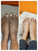 GlowPure™ - Kojie-San Skin Lightening Soap ✨With Essence Spray