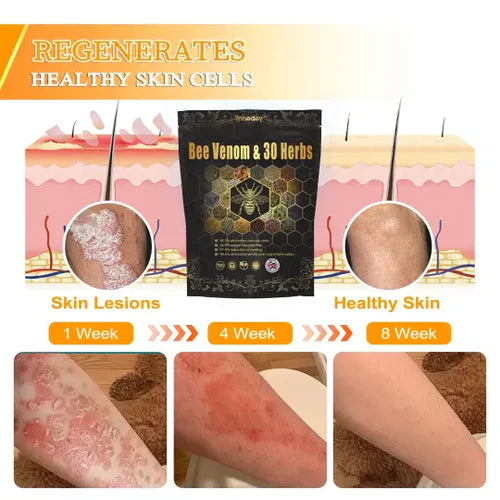 Bee Venom & 30-Herb Detox Foot Soak Beads for Body Sculpting (Buy 1 Get 1 Free)