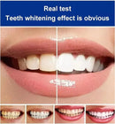 BrightenUp™ - SP-4 Ultra+ Teeth Whitening W Free Mist