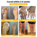 Thisave™ Bee Venom & Turmeric Arthritis Therapy Cream (Expertly crafted for orthopedic conditions and joint pain relief)